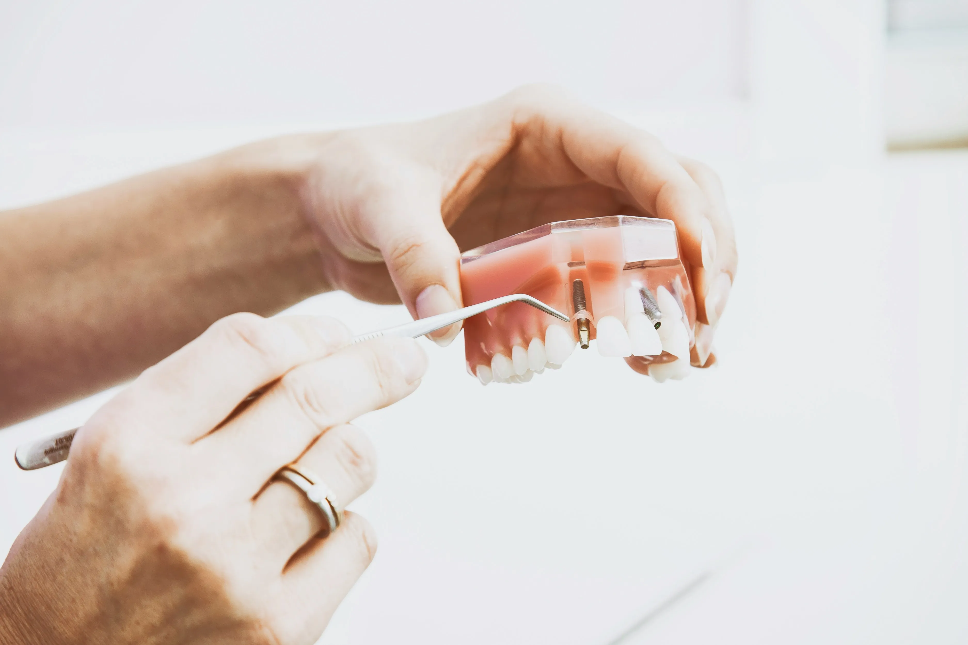 Modern dental implant model